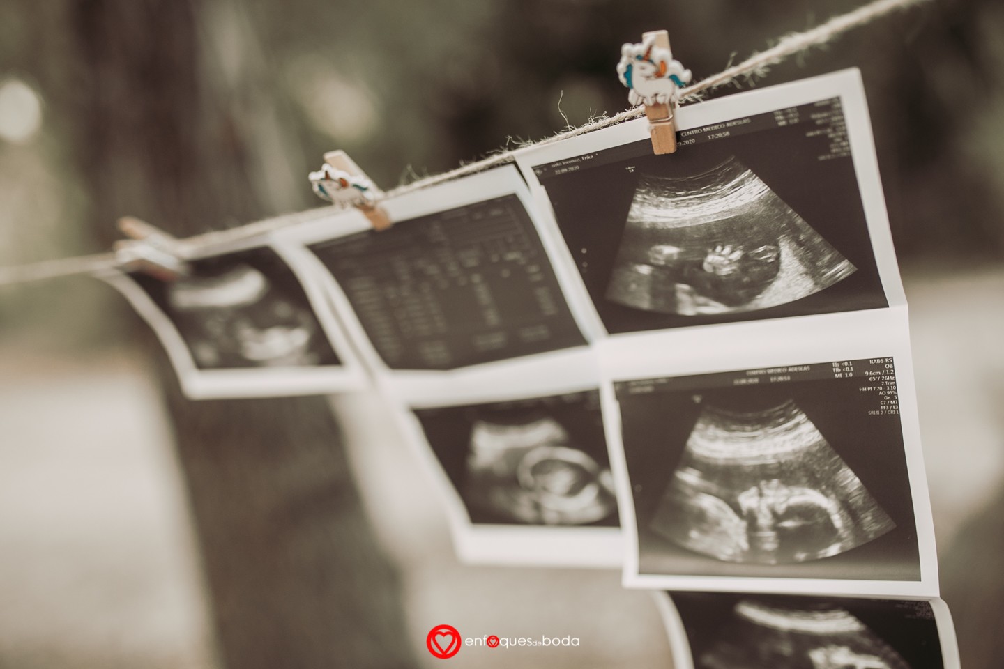 5P5A8088PREMAMA ERIKA